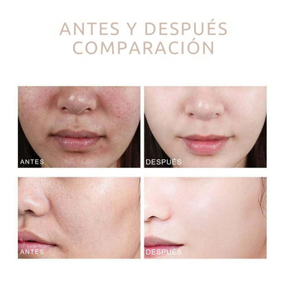 Exfoliante facial Dr. Melaxin Peel Shot