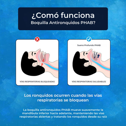 Boquilla Antironquidos PHAB